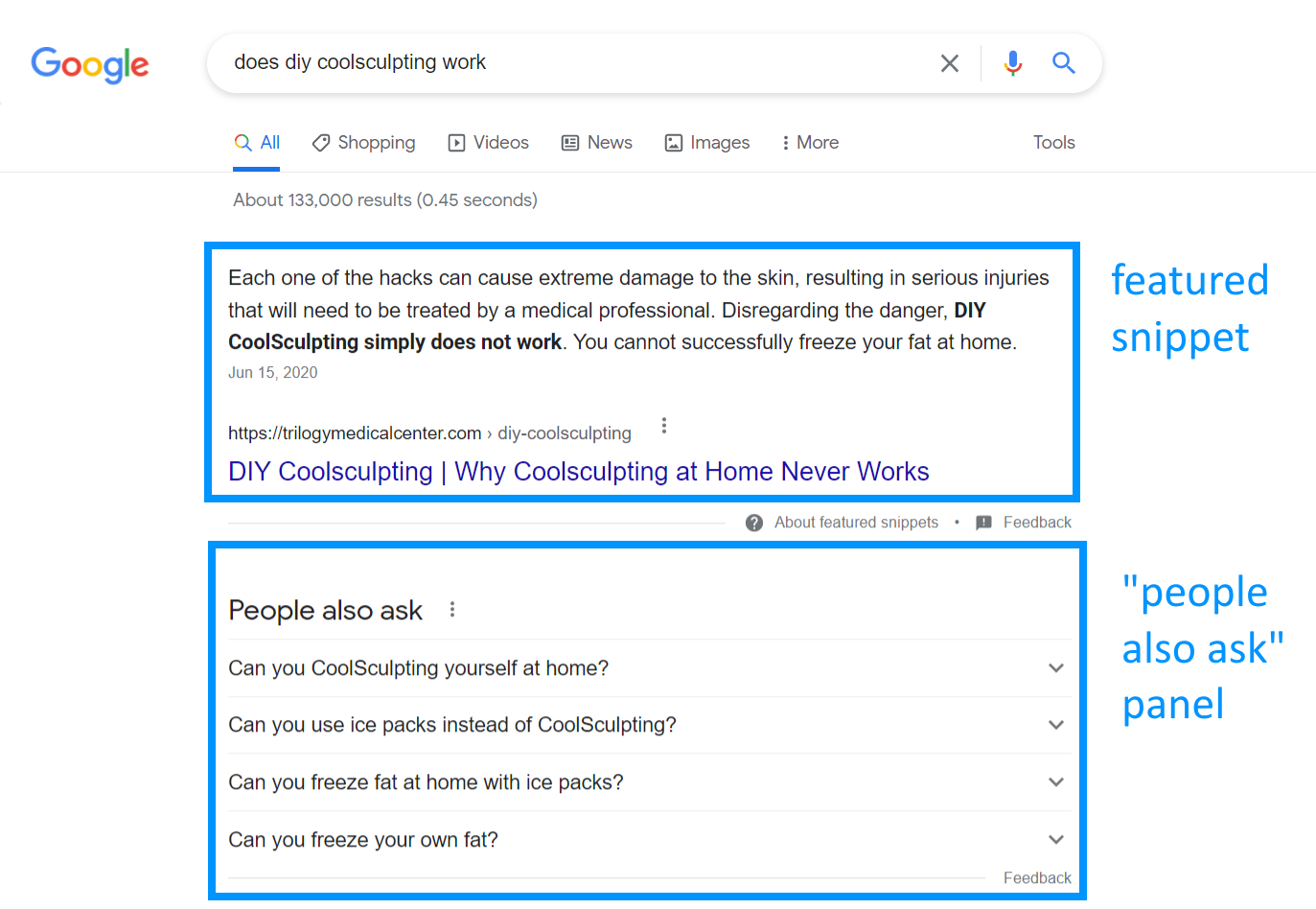 Google screen shot of Coolsculpting FAQ
