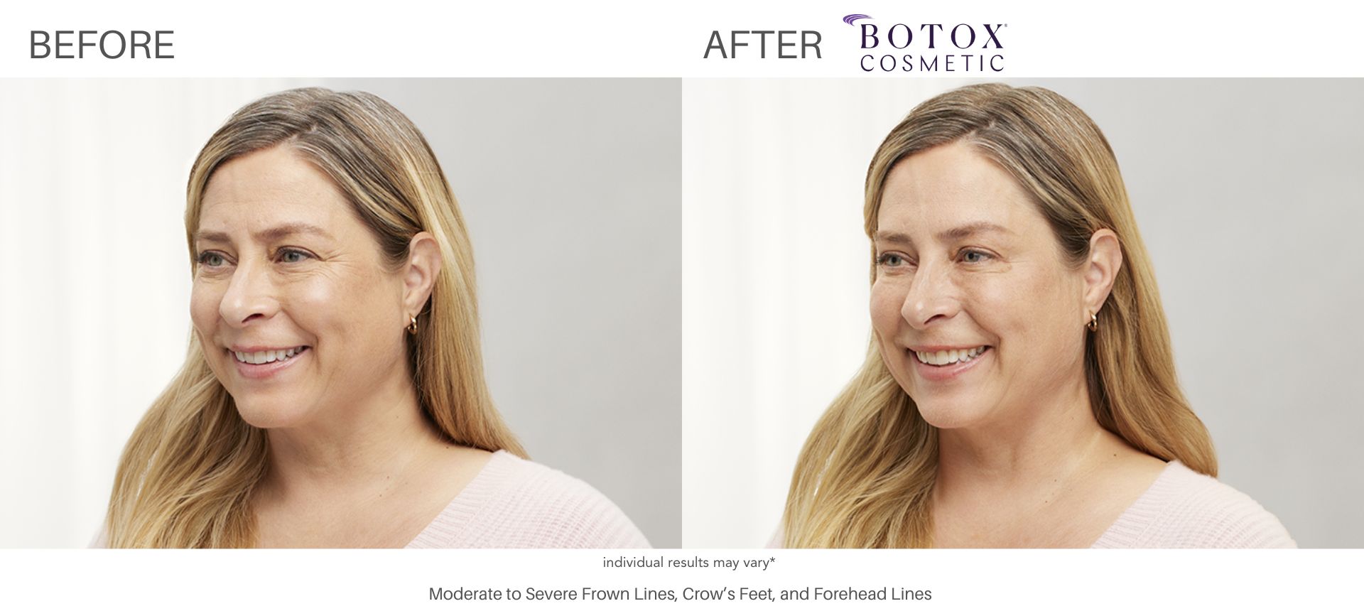 Before and after images are what a website needs attract more patients.
