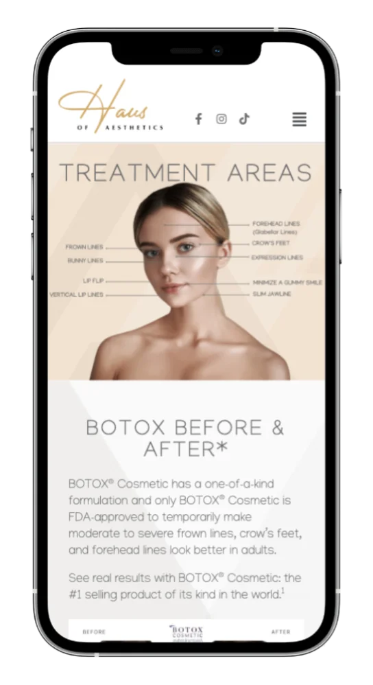 Haus of Aesthetics - Botox Page - Mobile View